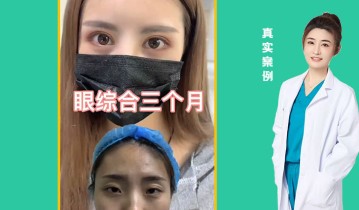 眼综合3个月效果