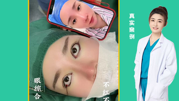 眼综合四项